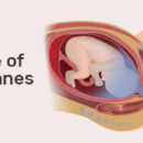 Rupture of membranes