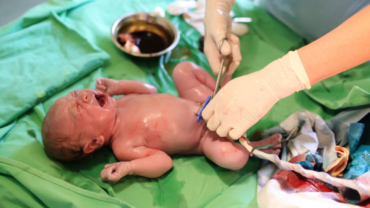 Umbilical Cord Milking – New Research for Non-vigorous Near-term Newborns -  My BabyManual